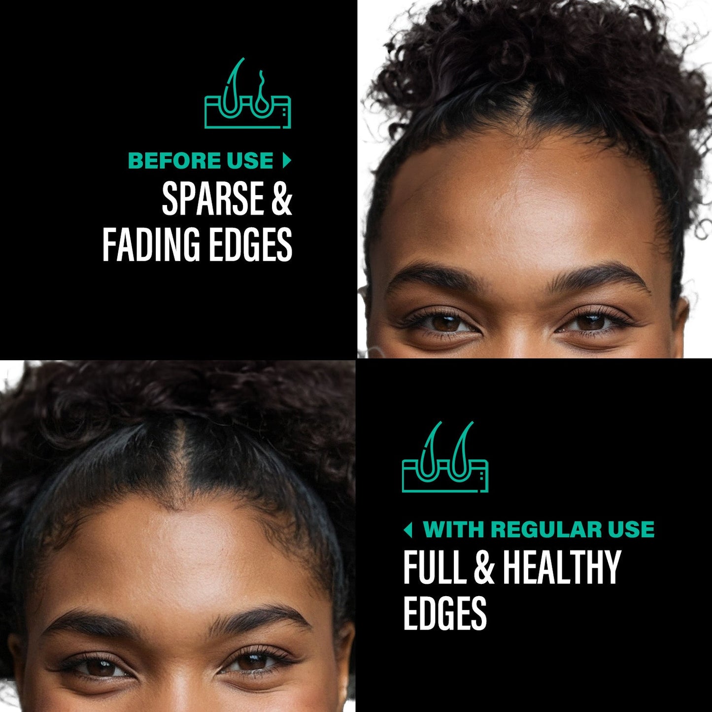 100% Natural Unrefined Batana oil Hair Growth & Thicker Hair