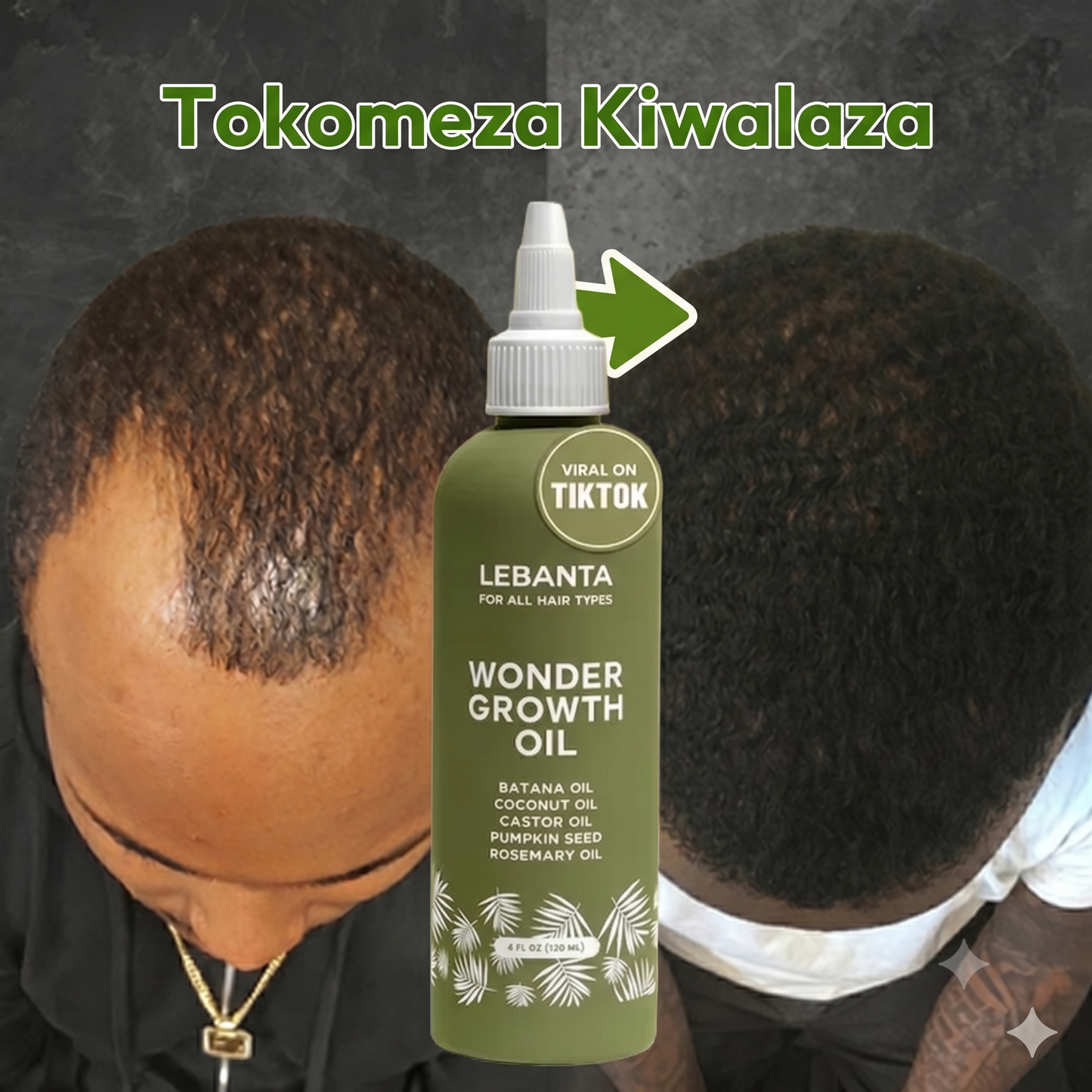 LeBanta 100% Natural Batana Oil for Intense Hair Growth