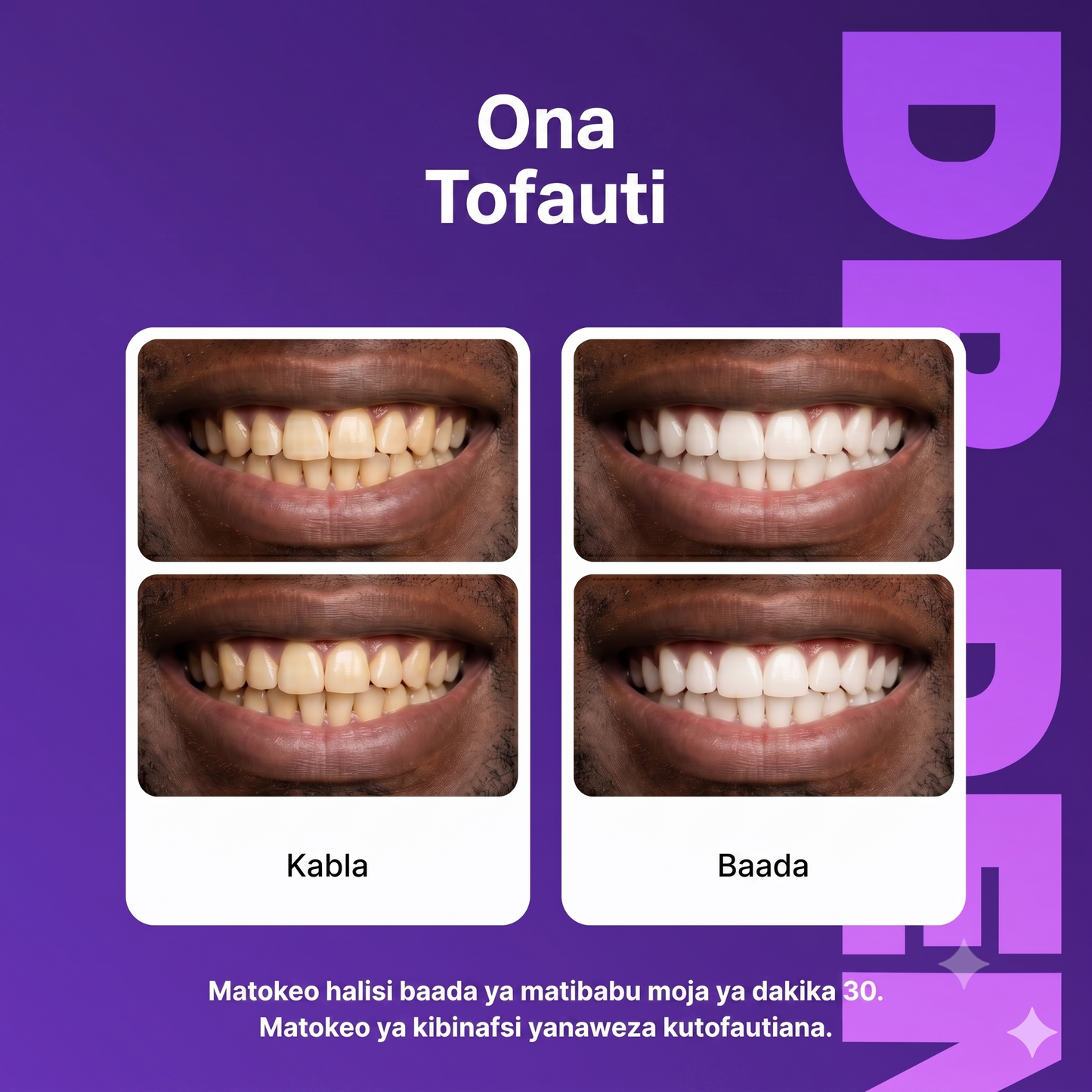 Kanda za Zambarau za Kung'arisha Meno