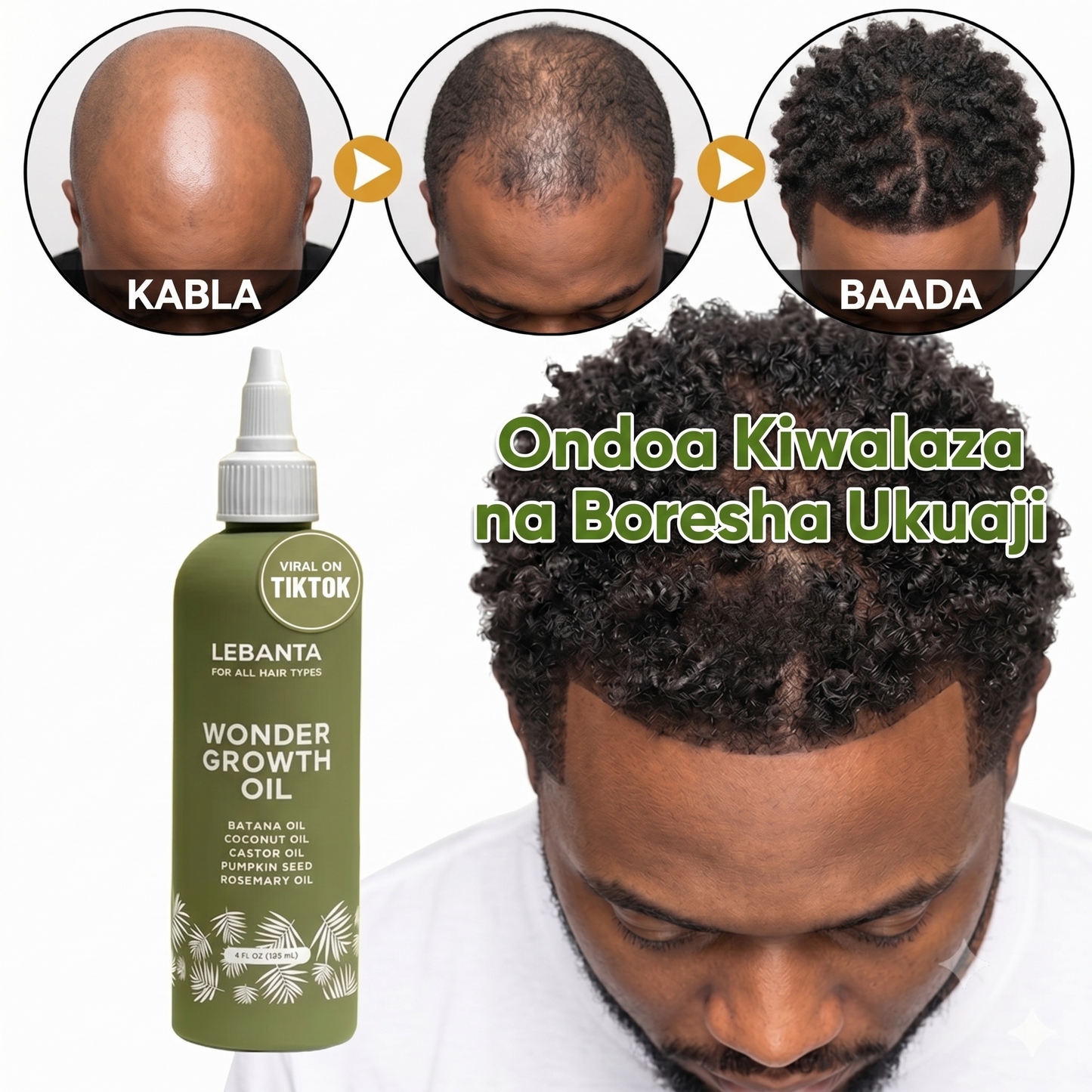 LeBanta 100% Natural Batana Oil for Intense Hair Growth