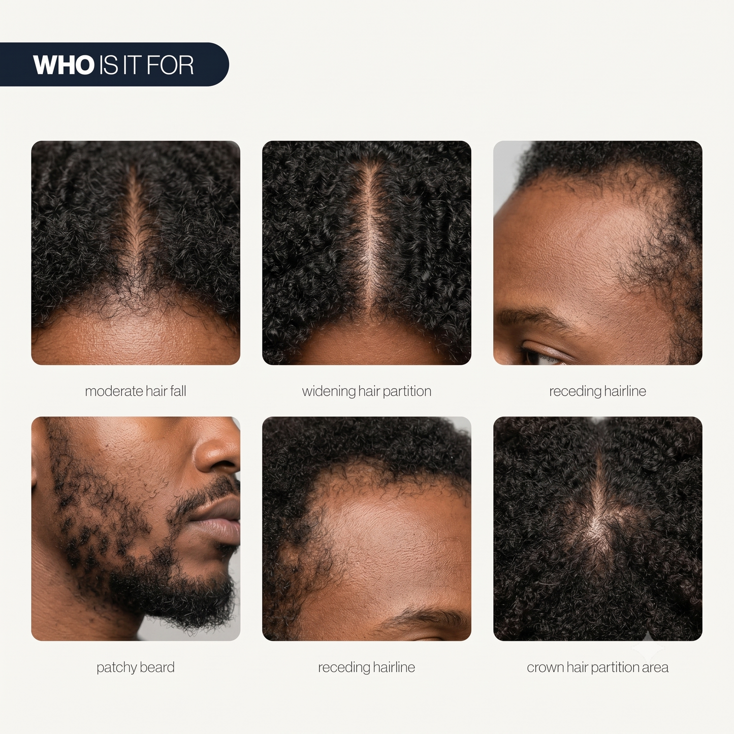 Advanced Hair Growth Serum Roll-On | 100% Natural