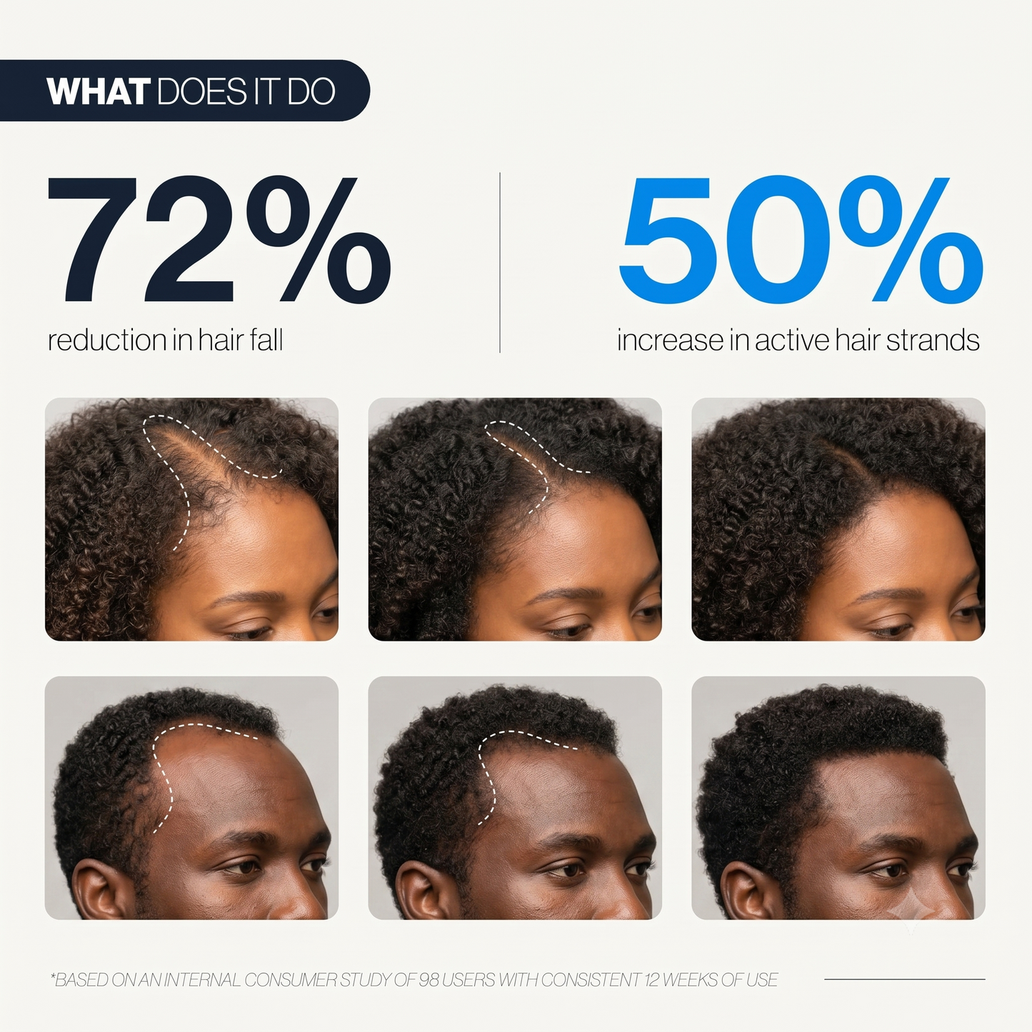 Advanced Hair Growth Serum Roll-On | 100% Natural