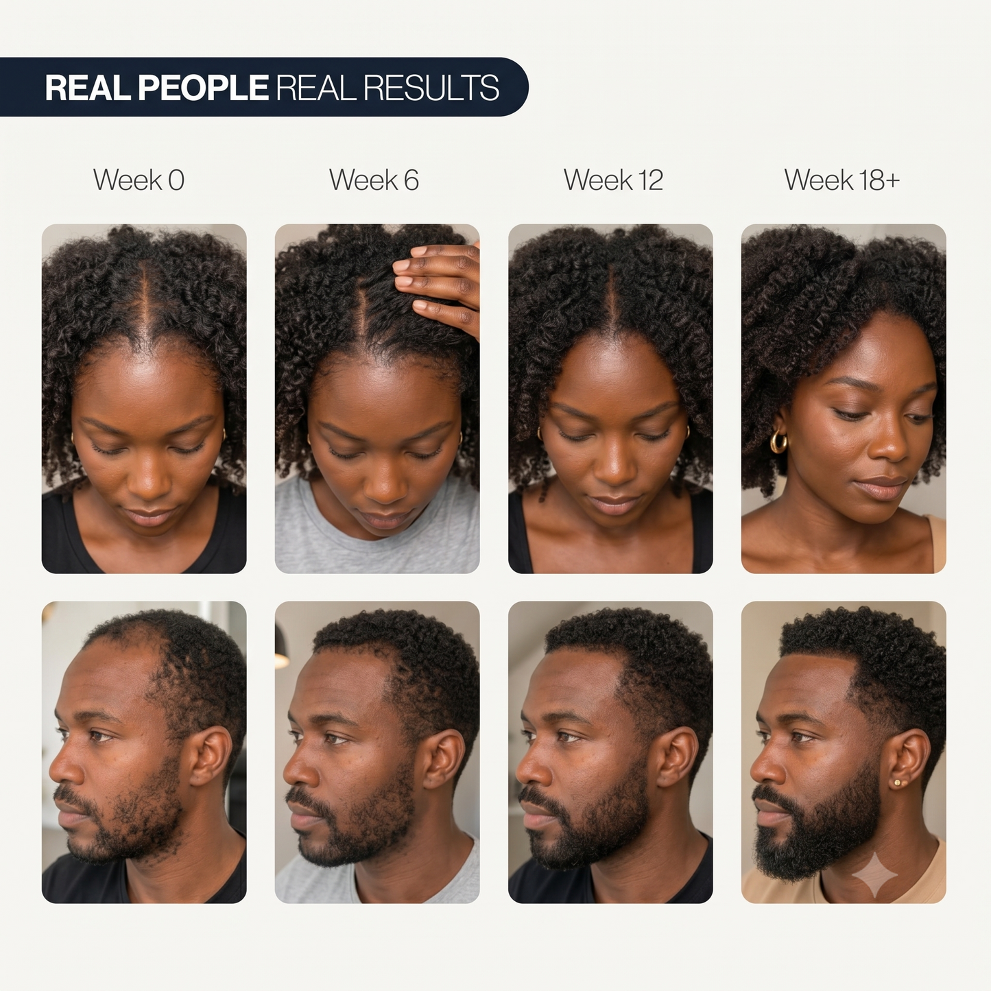 Advanced Hair Growth Serum Roll-On | 100% Natural