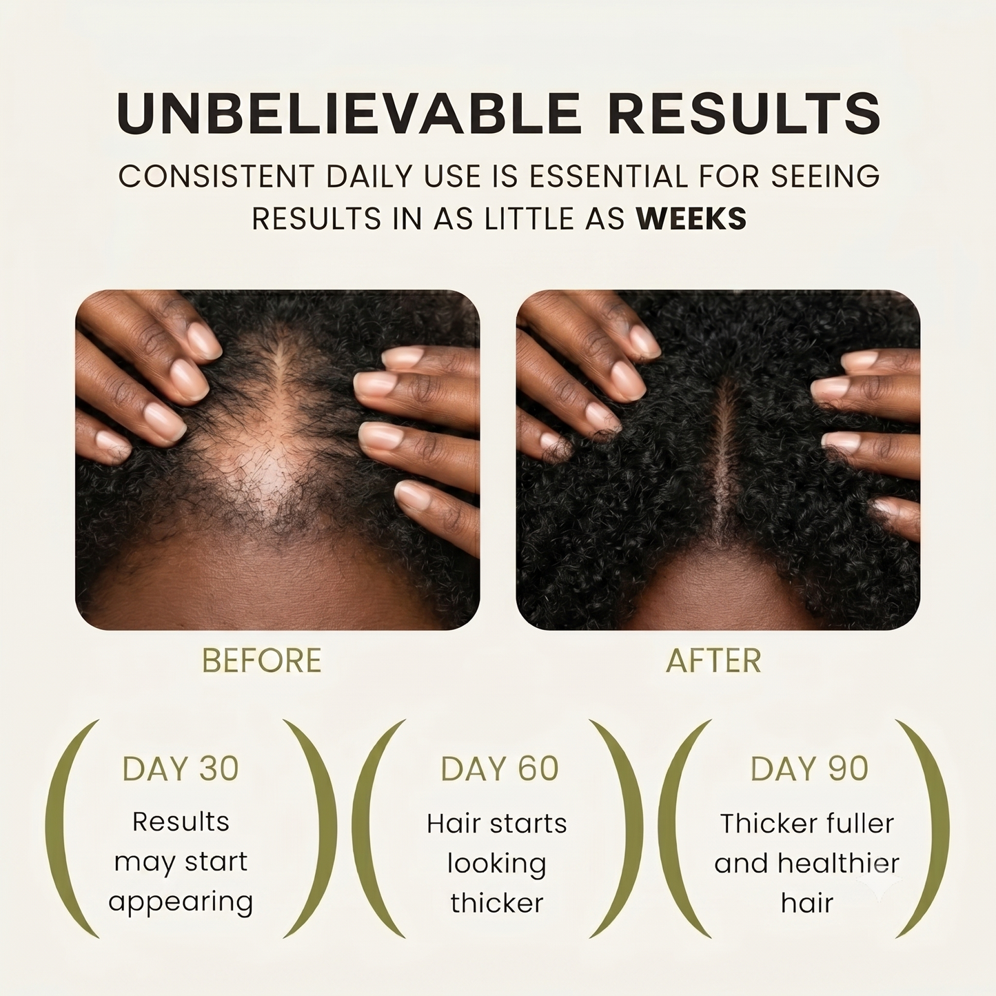 LeBanta 100% Natural Batana Oil for Intense Hair Growth